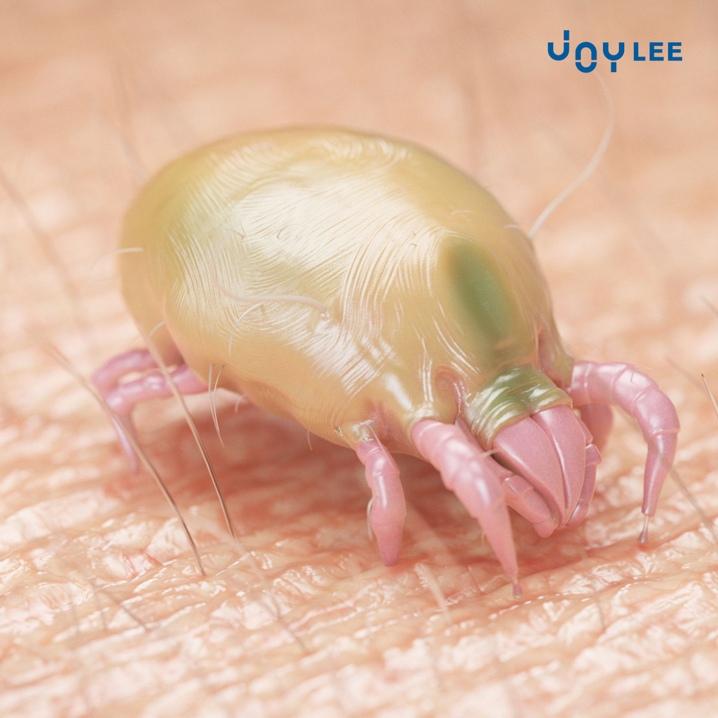 DUST MITES - OUR BIGGEST ENEMY OF ALLERGY
